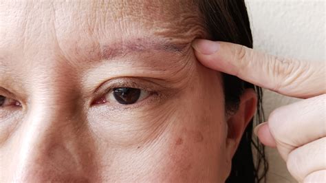 Exercises for Bell’s Palsy: 7 Facial Exercises That Can Help - GoodRx