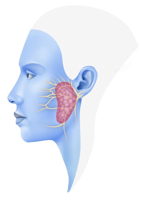Parotid Gland Tumor Symptoms