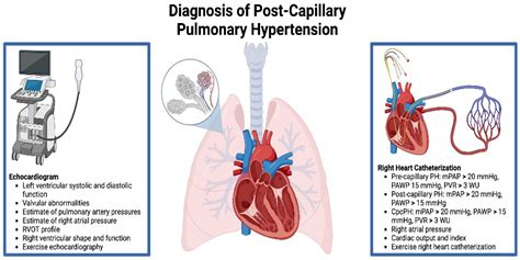 What Is Pulmonary Capillary Wedge Pressure A Measure Of - Infoupdate.org