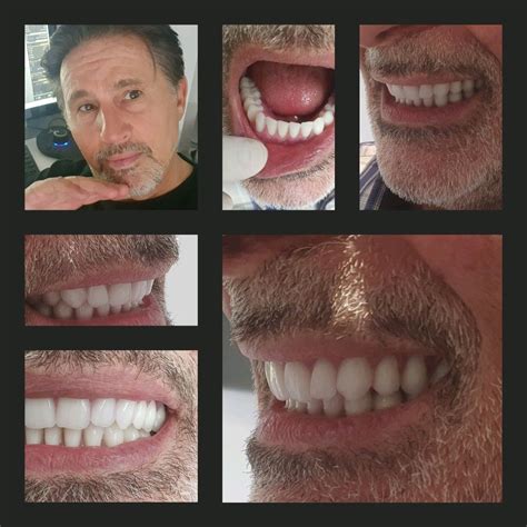 Onofrio Azzaretto on LinkedIn: this was a beautiful change for our ...