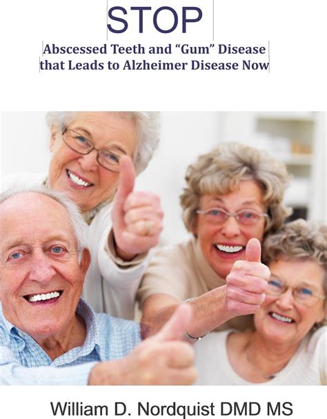 Buy Stop Painful Abscessed Teeth and “Gum” Disease that Leads to ...