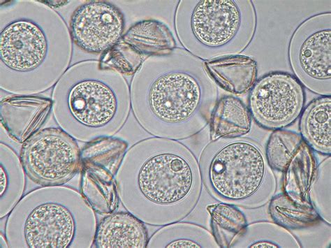 Image result for Juniper Tree Pollen Exploding