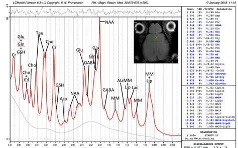 Image result for Prefrontal Cortex Mouse Brain