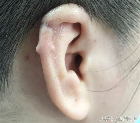 打耳洞的传闻是什么 关于打耳洞浪漫的说法有哪些 _八宝网
