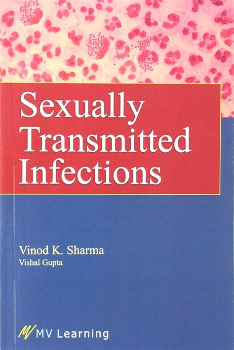 Buy Sexually Transmitted Infections Book Online at Low Prices in India ...