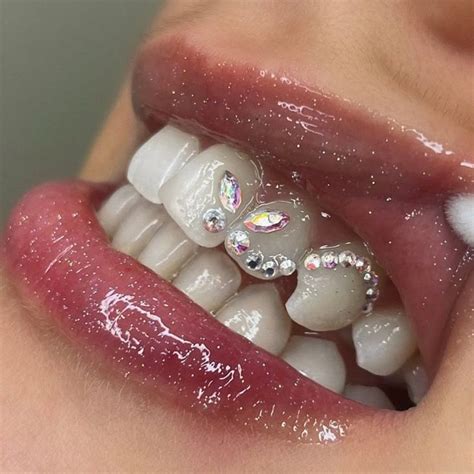 Image result for DIY Tooth Gems