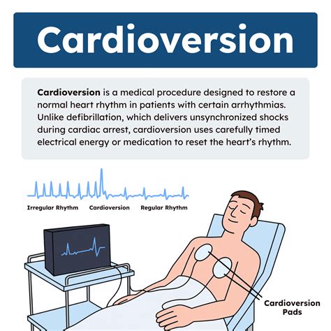 Cardioversion: Overview and Practice Questions (2026)