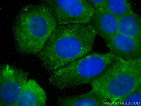 HARS antibody (67662-1-Ig) | Proteintech