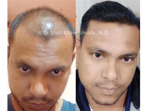 Meet India's Hair Growth Queen:- Dr Stuti Khare Shukla - Times of India