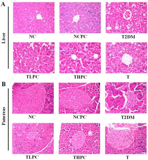 Phycocyanin Protects against High Glucose High Fat Diet Induced ...