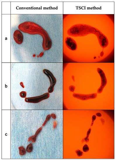 JCM | Special Issue : Latest Advances in Endoscopic Imaging and Therapy ...