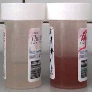 Image result for Visual Test Product Assessment Sample