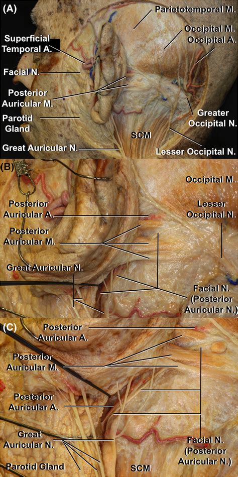 Posterior Auricular Artery