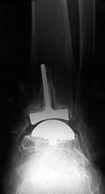 Hardware Monitor Driver 的图像结果