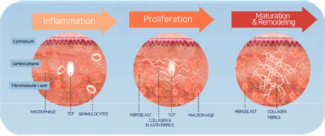 Cosmetic Gynaecology | Mechanism of New Collagen Regeneration