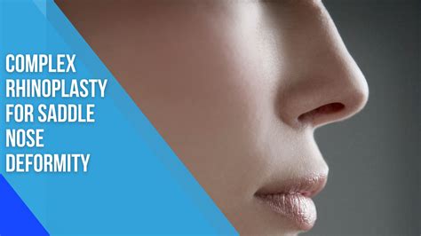 Saddle Nose Deformity Causes | Rhinoplasty Surgeon India