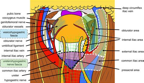 Japanese expert consensus on the standardization of robot‐assisted pelvic lymph node dissection ...