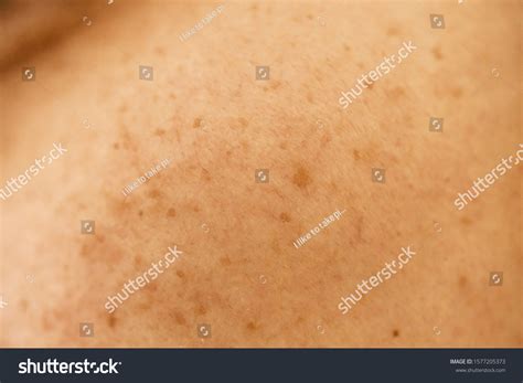 Image result for Melisma Examples