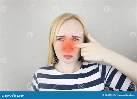 A Young Woman Touches Her Nose, Which is Very Painful. Medical Care Concept for Difficulty ...