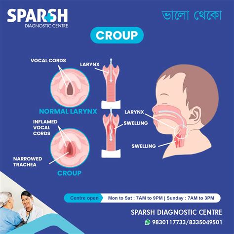 Croup - Sparsh Diagnostic Center