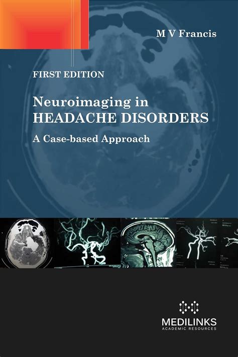 Buy Neuroimaging in Headache Disorders: A Case-based Approach Book ...