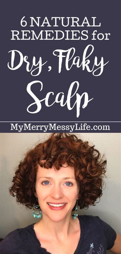 natural remedies dry scalp