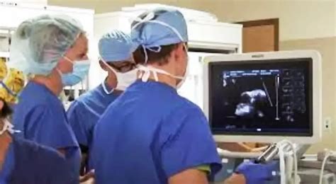 Image result for Laser Lead Extraction Animation Spectranetics