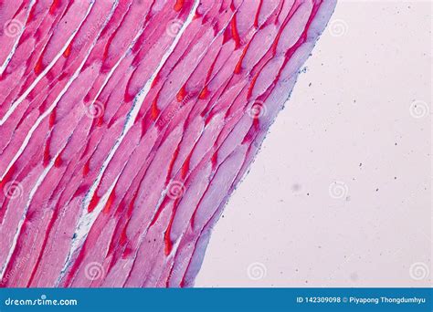 Image result for Skeletal Muscle Tissue Under Microscope