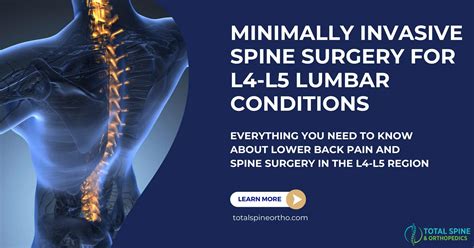 Lumbar Spine Surgery Lumbar Spinal Stenosis | London Spine Unit | UK's