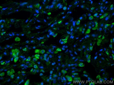 Angiopoietin 1 antibody (81990-4-RR) | Proteintech