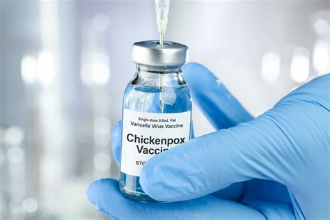 Chickenpox Vaccine For Children | Childhealthy London