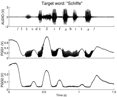 Image result for Transillumination Normal Head