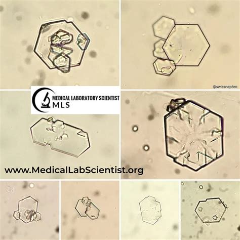 MICROSCOPIC URINALYSIS - Medical Laboratory Scientist MLS