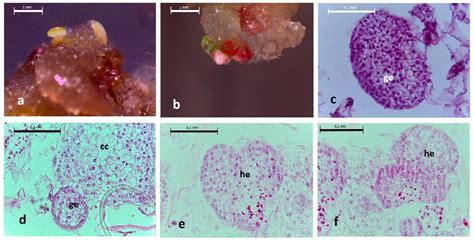 Spontaneous Regeneration of Plantlets Derived from Hairy Root Cultures ...