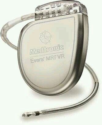 Image result for Pacemaker X-ray Algorithm