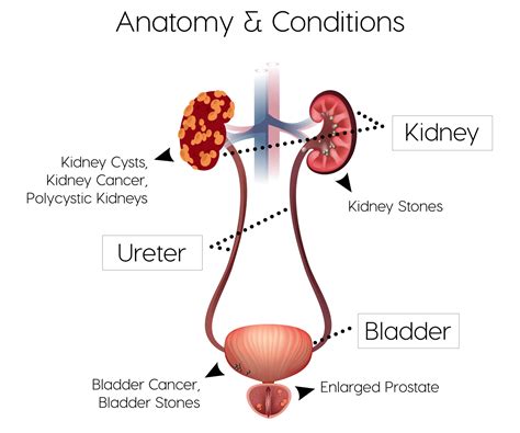 Kidney, Ureter, Bladder - rejuvencescans.co.uk