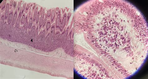 Image result for Small Intestine Jejunum