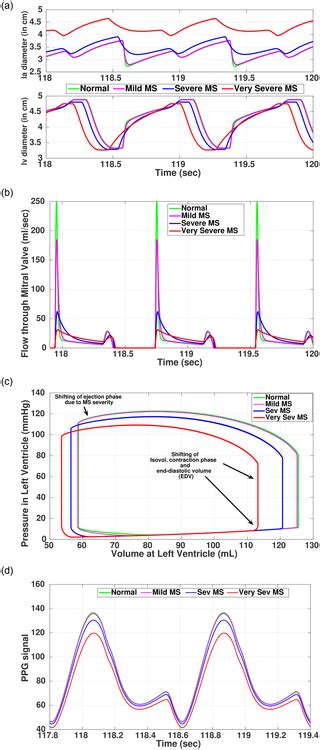 Image result for Multi Dynamic Vena Modeling