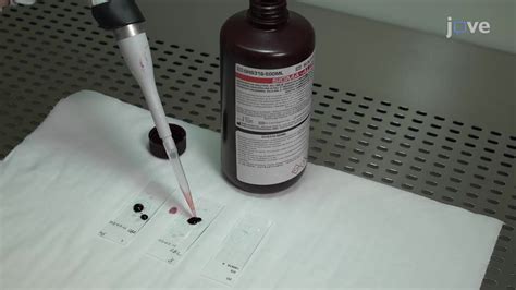 Video: Periodic Acid Schiff or PAS Staining: A Method to Assess the ...