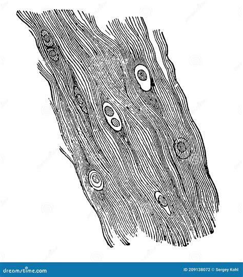 Image result for Deep Tissue Cartoon