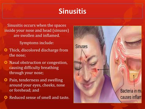 Nose and Sinus Disorders | PPTX