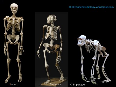 Image result for Skeleton Brain Exploding