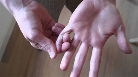 breaking/dislocating my own finger! the easy way - YouTube