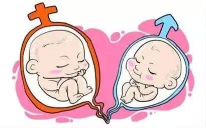 双胞胎分娩时要注意哪些情况
