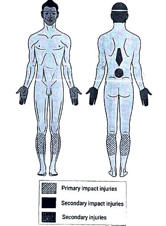 Pedestrian Injuries - Medical Science Optional Notes for UPSC PDF Download