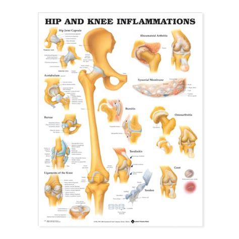 Buy Hip and Knee Inflammations Book Online at Low Prices in India | Hip ...