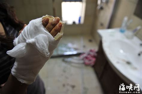 福州：女子洗澡时浴室玻璃门爆 裂割断手指肌腱 - 媒体关注 - 福建妇联新闻