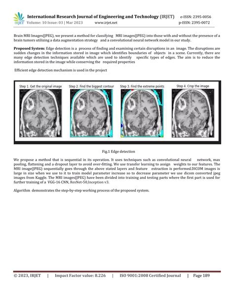 Image result for Deep Learning Algorithms Brain Tumor