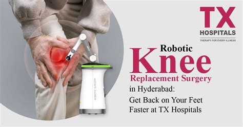 Robotic Knee Replacement Surgery in Hyderabad: Get Back on Your Feet ...