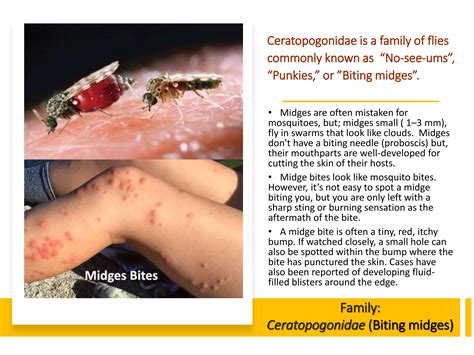 1 arthropod allergy.pptx